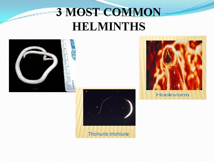 3 MOST COMMON HELMINTHS 