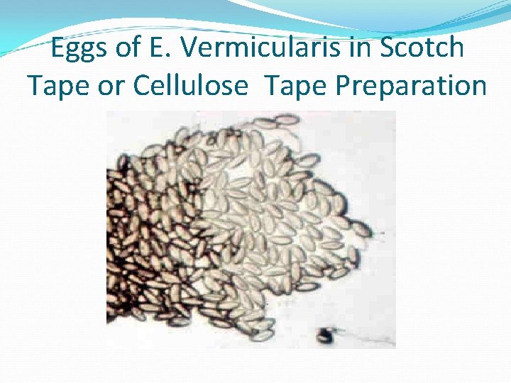 Eggs of E. Vermicularis in Scotch Tape or Cellulose Tape Preparation 