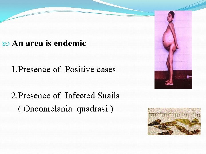  An area is endemic: 1. Presence of Positive cases 2. Presence of Infected