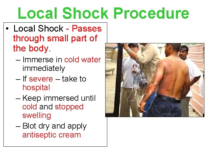 Local Shock Procedure • Local Shock - Passes through small part of the body.