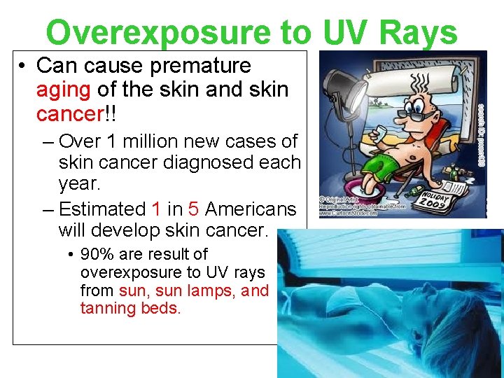 Overexposure to UV Rays • Can cause premature aging of the skin and skin