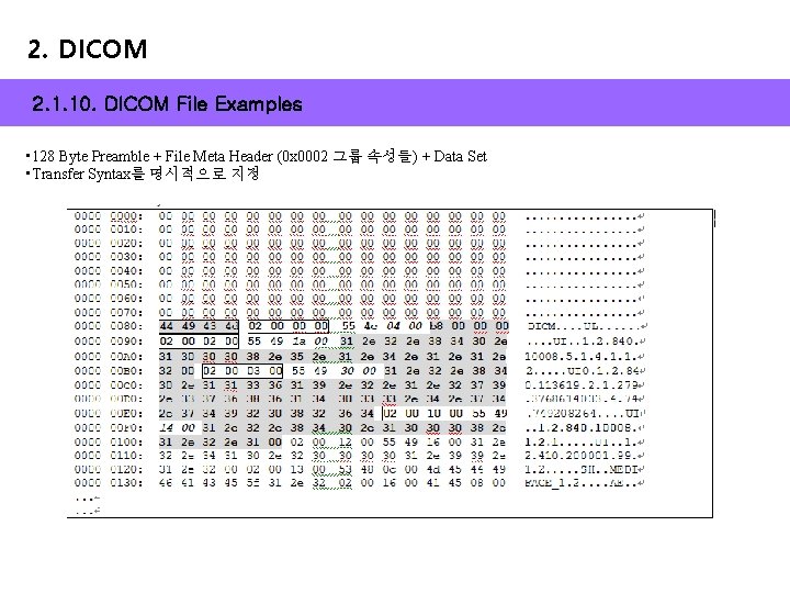 2. DICOM 2. 1. 10. DICOM File Examples • 128 Byte Preamble + File