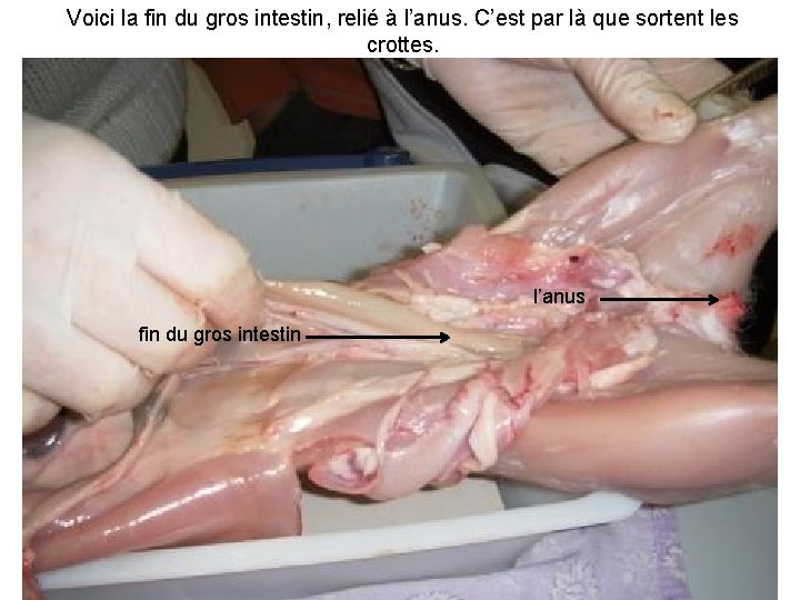Voici la fin du gros intestin, relié à l’anus. C’est par là que sortent