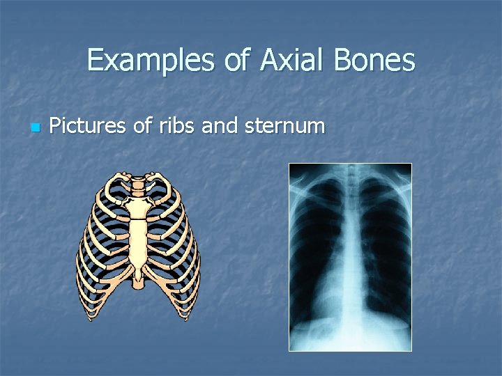 Examples of Axial Bones n Pictures of ribs and sternum 