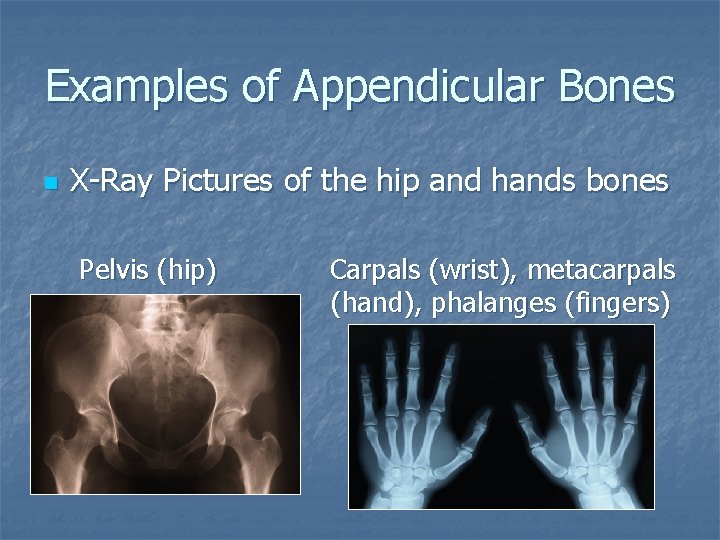 Examples of Appendicular Bones n X-Ray Pictures of the hip and hands bones Pelvis
