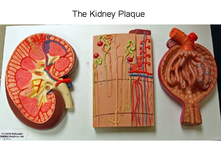 The Kidney Plaque The Kidney Plaque