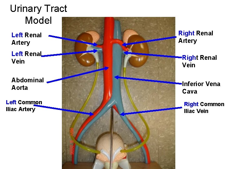 Urinary Tract Model Left Renal Artery Left Renal Vein Abdominal Aorta Left Common Iliac Urinary Tract Model Left Renal Artery Left Renal Vein Abdominal Aorta Left Common Iliac
