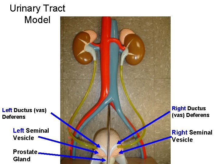 Urinary Tract Model Left Ductus (vas) Deferens Left Seminal Vesicle Prostate Gland Right Ductus Urinary Tract Model Left Ductus (vas) Deferens Left Seminal Vesicle Prostate Gland Right Ductus