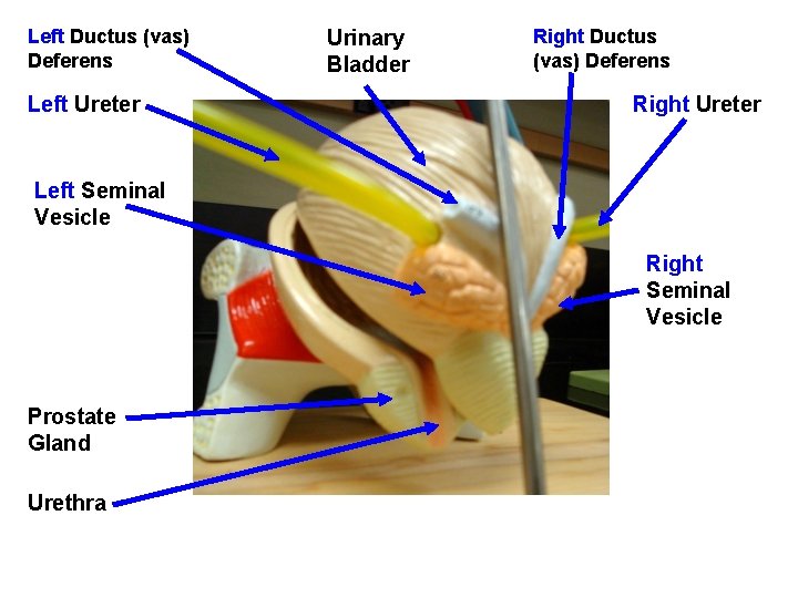 Left Ductus (vas) Deferens Left Ureter Urinary Bladder Right Ductus (vas) Deferens Right Ureter Left Ductus (vas) Deferens Left Ureter Urinary Bladder Right Ductus (vas) Deferens Right Ureter
