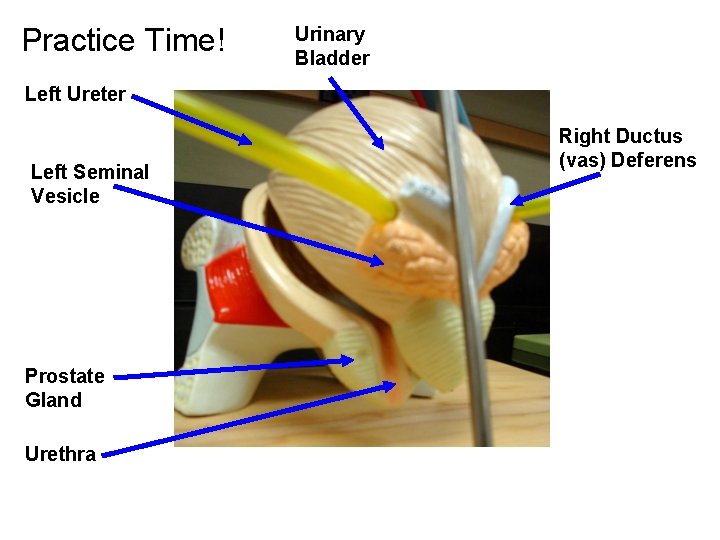 Practice Time! Urinary Bladder Left Ureter Left Seminal Vesicle Prostate Gland Urethra Right Ductus Practice Time! Urinary Bladder Left Ureter Left Seminal Vesicle Prostate Gland Urethra Right Ductus