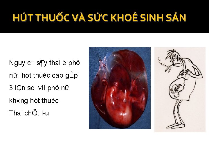 HÚT THUỐC VÀ SỨC KHOẺ SINH SẢN Nguy c¬ s¶y thai ë phô nữ