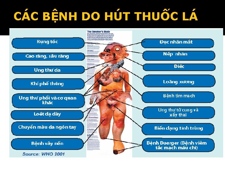 CÁC BỆNH DO HÚT THUỐC LÁ 