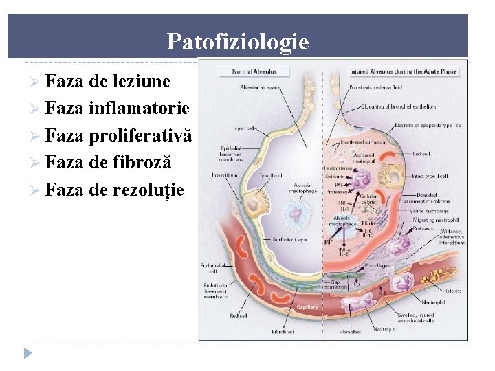 Patofiziologie Ø Faza de leziune Ø Faza inflamatorie Ø Faza proliferativă Ø Faza de