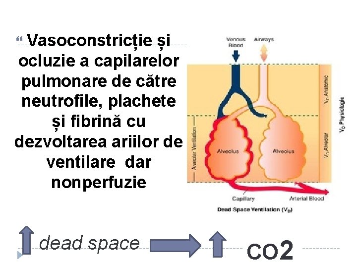  Vasoconstricție și ocluzie a capilarelor pulmonare de către neutrofile, plachete și fibrină cu