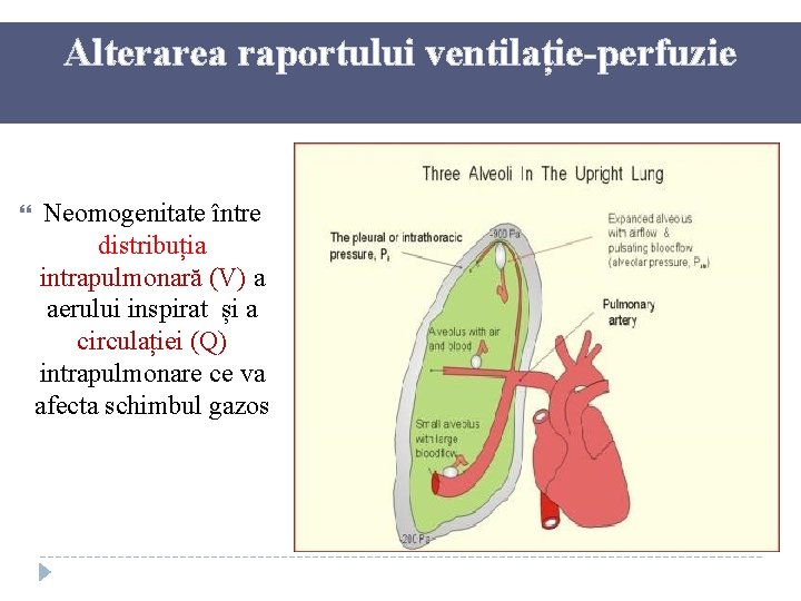 Alterarea raportului ventilație-perfuzie Neomogenitate între distribuția intrapulmonară (V) a aerului inspirat și a circulației