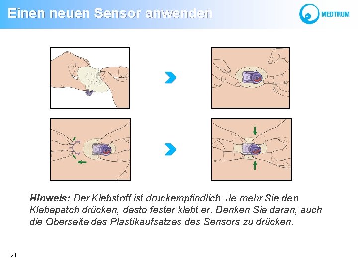 Einen neuen Sensor anwenden Hinweis: Der Klebstoff ist druckempfindlich. Je mehr Sie den Einen neuen Sensor anwenden Hinweis: Der Klebstoff ist druckempfindlich. Je mehr Sie den