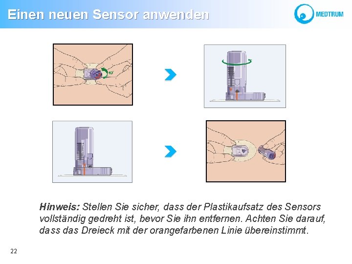  Einen neuen Sensor anwenden Hinweis: Stellen Sie sicher, dass der Plastikaufsatz des Sensors