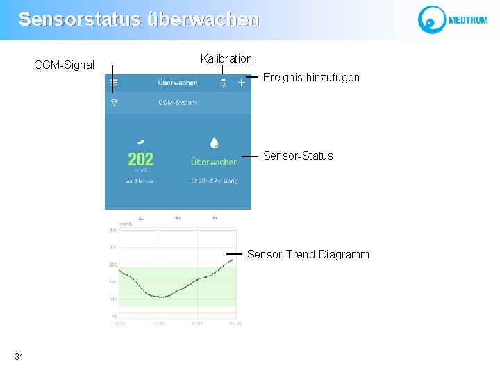  Sensorstatus überwachen CGM-Signal Kalibration Ereignis hinzufügen Sensor-Status Sensor-Trend-Diagramm 31 