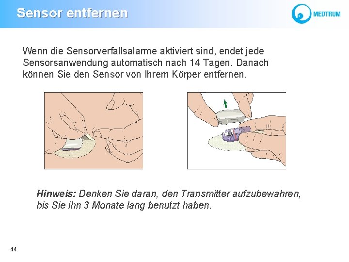  Sensor entfernen Wenn die Sensorverfallsalarme aktiviert sind, endet jede Sensorsanwendung automatisch nach 14