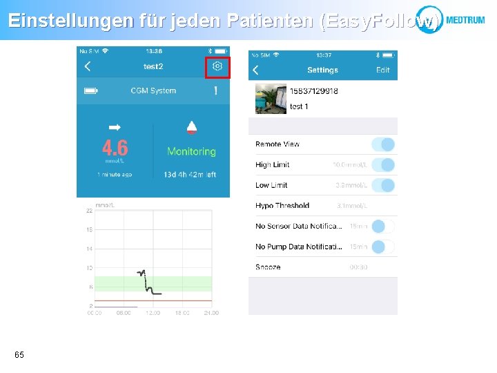 Einstellungen für jeden Patienten (Easy. Follow) 65 