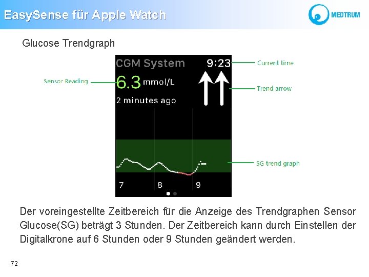 Easy. Sense für Apple Watch Glucose Trendgraph Der voreingestellte Zeitbereich für die Anzeige des