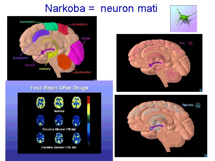 Narkoba = neuron mati 