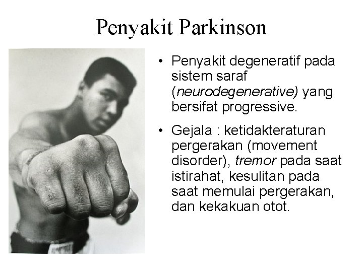 Penyakit Parkinson • Penyakit degeneratif pada sistem saraf (neurodegenerative) yang bersifat progressive. • Gejala
