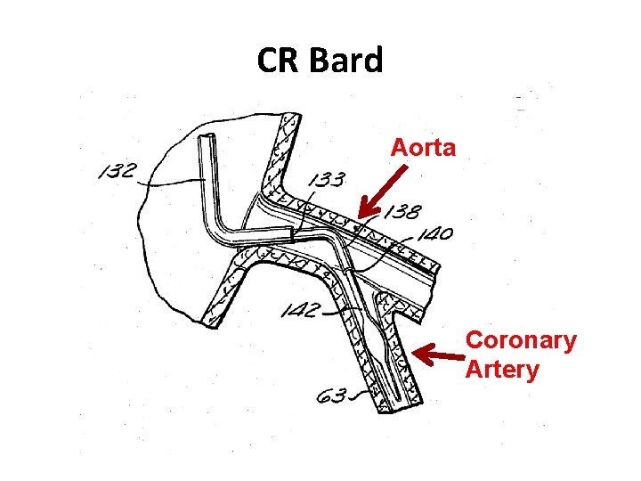 CR Bard Aorta Coronary Artery 