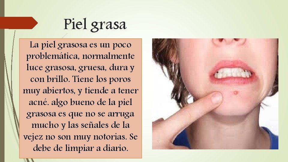 Piel grasa La piel grasosa es un poco problemática, normalmente luce grasosa, gruesa, dura