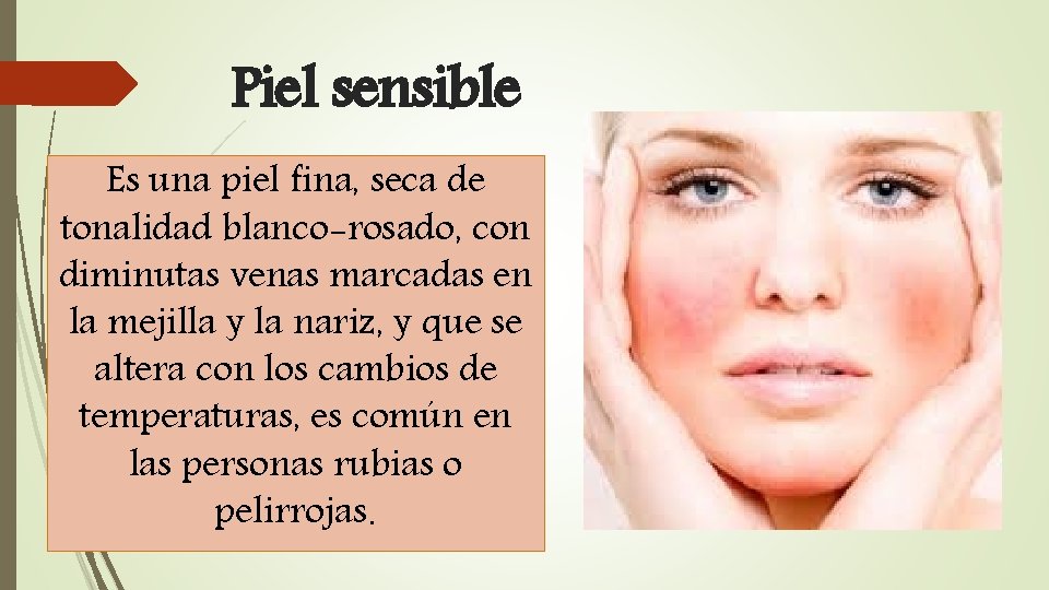 Piel sensible Es una piel fina, seca de tonalidad blanco-rosado, con diminutas venas marcadas