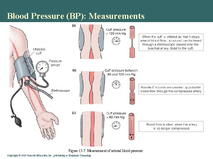 Blood Pressure (BP): Measurements Figure 15 -7: Measurement of arterial blood pressure Copyright ©