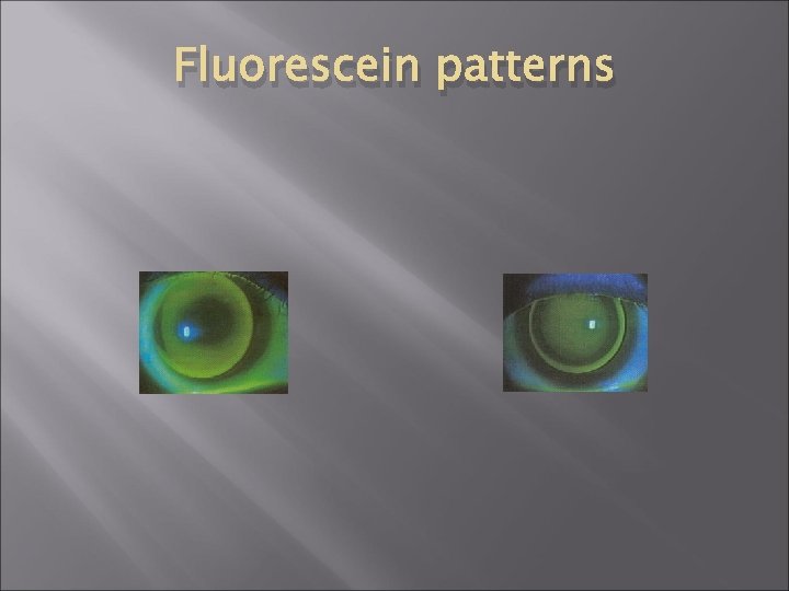 Fluorescein patterns 