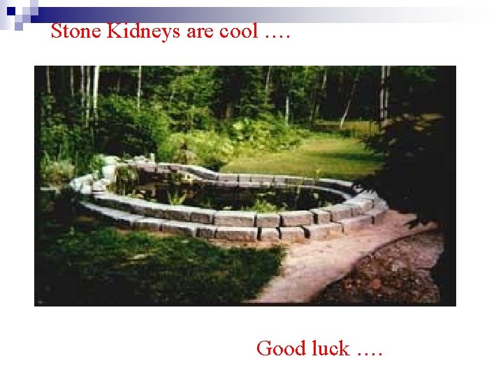 Stone Kidneys are cool …. Good luck …. 