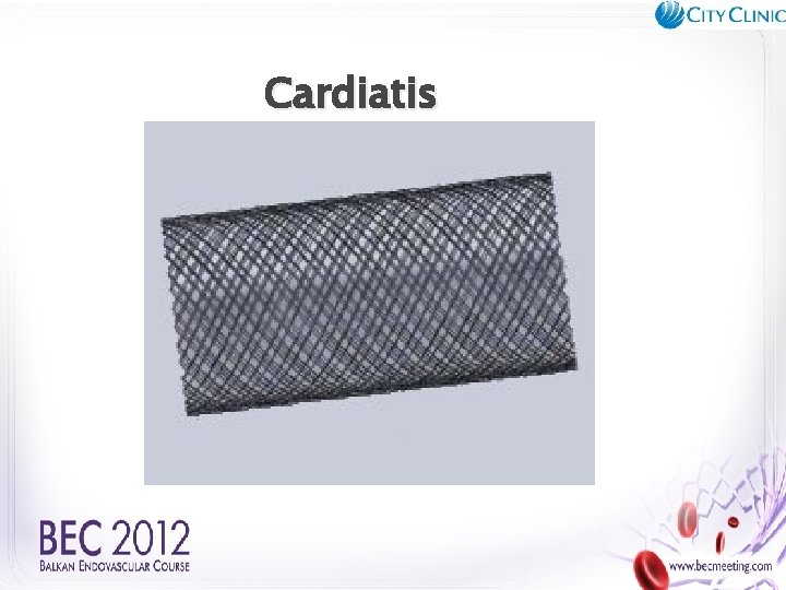 Cardiatis 