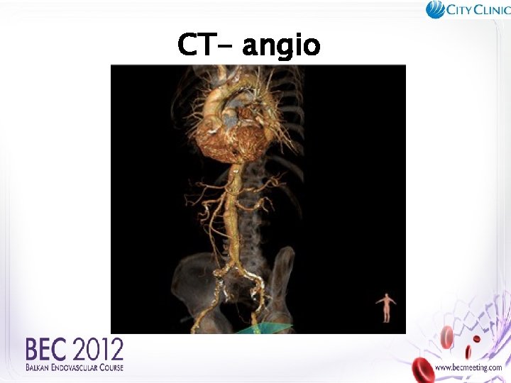 CT- angio SMA 