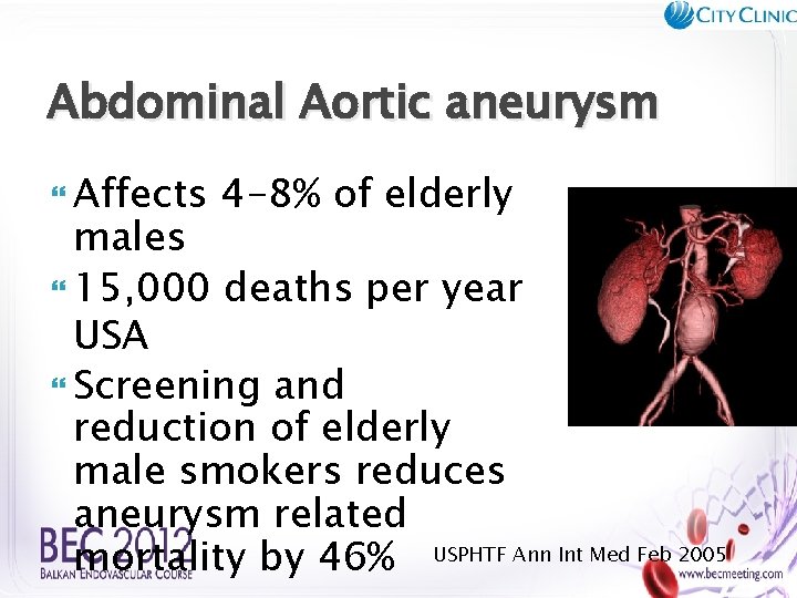 Abdominal Aortic aneurysm Affects 4 -8% of elderly males 15, 000 deaths per year