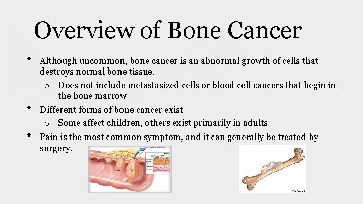 Overview of Bone Cancer • • • Although uncommon, bone cancer is an abnormal Overview of Bone Cancer • • • Although uncommon, bone cancer is an abnormal