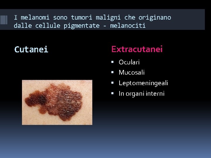 I melanomi sono tumori maligni che originano dalle cellule pigmentate - melanociti Cutanei Extracutanei