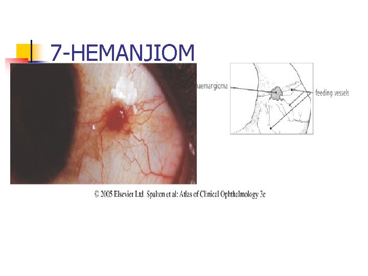 7 -HEMANJIOM 7 -HEMANJIOM