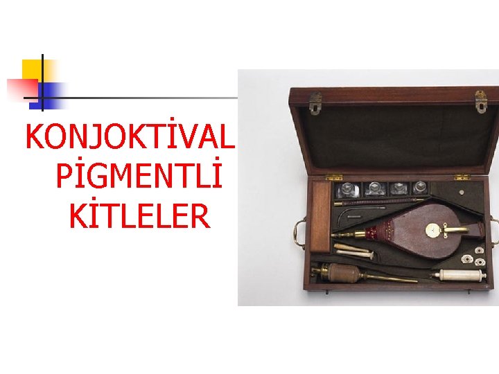 KONJOKTİVAL PİGMENTLİ KİTLELER KONJOKTİVAL PİGMENTLİ KİTLELER
