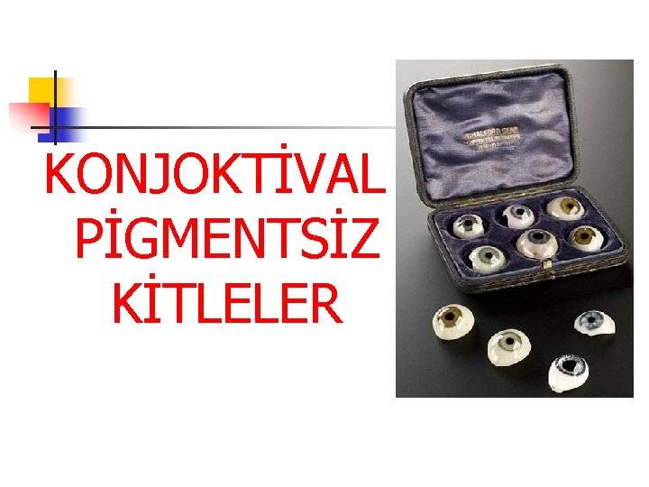 KONJOKTİVAL PİGMENTSİZ KİTLELER KONJOKTİVAL PİGMENTSİZ KİTLELER