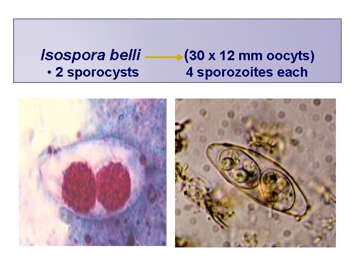 Isospora belli (30 x 12 mm oocyts) • 2 sporocysts 4 sporozoites each 