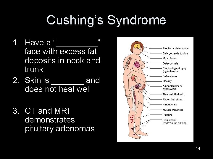 Cushing’s Syndrome 1. Have a “_____” face with excess fat deposits in neck and