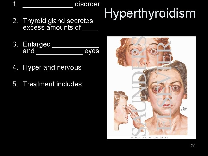 1. _______ disorder 2. Thyroid gland secretes excess amounts of ____ Hyperthyroidism 3. Enlarged