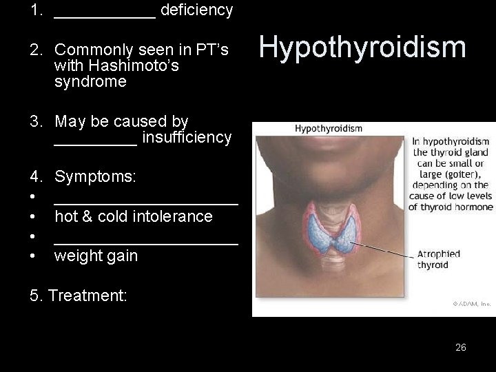 1. ______ deficiency 2. Commonly seen in PT’s with Hashimoto’s syndrome Hypothyroidism 3. May