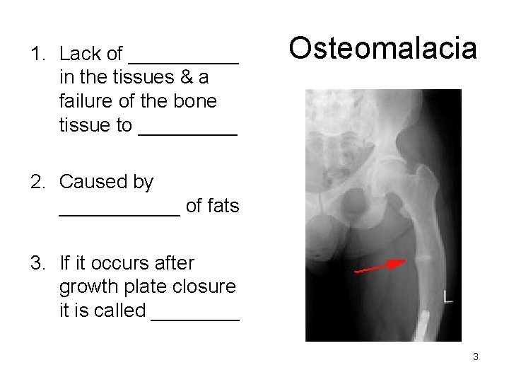 1. Lack of _____ in the tissues & a failure of the bone tissue