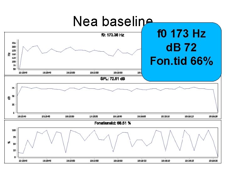 Nea baseline f 0 173 Hz d. B 72 Fon. tid 66% 