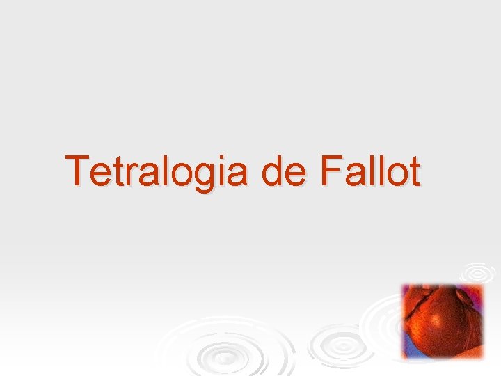 Tetralogia de Fallot 