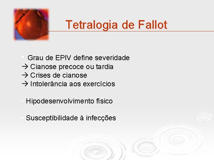 Tetralogia de Fallot • Grau de EPIV define severidade Cianose precoce ou tardia Crises