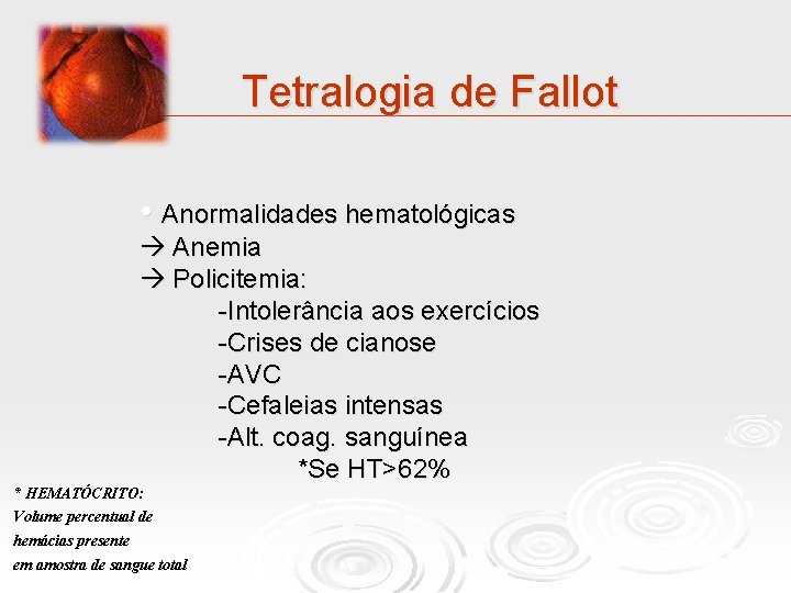 Tetralogia de Fallot • Anormalidades hematológicas Anemia Policitemia: -Intolerância aos exercícios -Crises de cianose